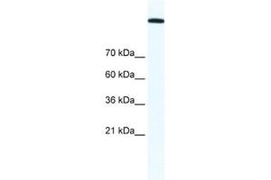 Western Blotting (WB) image for anti-Topoisomerase (DNA) II alpha 170kDa (TOP2A) antibody (ABIN2463687) (Topoisomerase II alpha antibody)