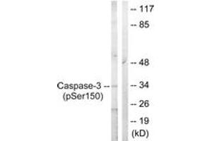 Western blot analysis of extracts from Jurkat cells treated with Etoposide 25uM 60', using Caspase 3 (Phospho-Ser150) Antibody. (Caspase 3 antibody  (pSer150))
