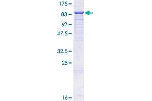 ALOX12 Protein (AA 1-663) (GST tag)