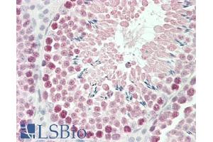 ABIN185724 (5µg/ml) staining of paraffin embedded Mouse Testis. (ROBO1 antibody  (Internal Region))