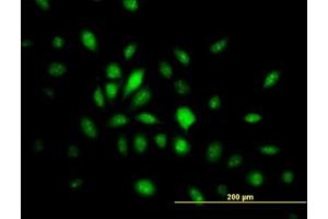 Image no. 4 for anti-High Mobility Group 20B (HMG20B) (AA 1-110) antibody (ABIN599130) (HMG20B antibody  (AA 1-110))