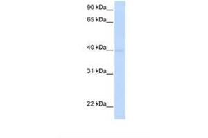 Image no. 1 for anti-Solute Carrier Family 25, Member 36 (SLC25A36) (AA 36-85) antibody (ABIN6738104) (SLC25A36 antibody  (AA 36-85))