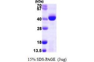 SDS-PAGE (SDS) image for AlkB, Alkylation Repair Homolog 3 (ALKBH3) (AA 1-286) protein (His tag) (ABIN667398)