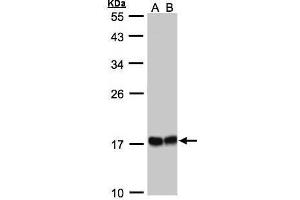WB Image Sample(30 ug whole cell lysate) A:293T whole cell lysate B:A431, 12% SDS PAGE antibody diluted at 1:1000 (HSPB8 antibody  (C-Term))