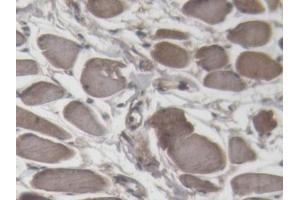 Immunohistochemistry (IHC) image for anti-Cardiac Troponin I (TNNI3) (AA 2-211) antibody (ABIN7431860)