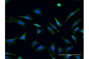 Immunofluorescence of monoclonal antibody to RHOT1 on HeLa cell. (RHOT1 antibody  (AA 483-580))