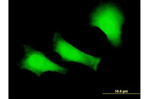 Immunofluorescence of monoclonal antibody to FANCC on HeLa cell. (FANCC antibody  (AA 1-100))