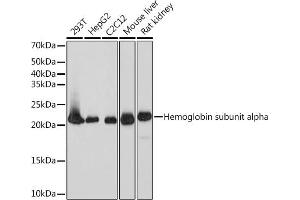 Western blot analysis of extracts of various cell lines, using DHFR Rabbit mAb (ABIN7266764) at 1:1000 dilution. (Dihydrofolate Reductase antibody)