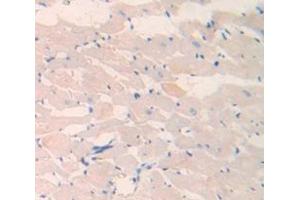 Used in DAB staining on fromalin fixed paraffin- embedded Kidney tissue (LAMC2 antibody  (AA 1003-1192))