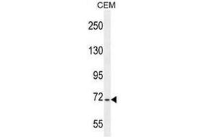 STIM1 Antibody (C-term) western blot analysis in CEM cell line lysates (35µg/lane).