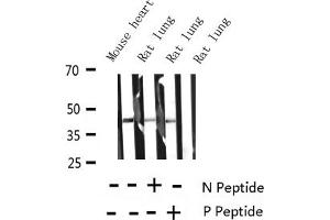 Western blot analysis of Phospho-MARCKS (Ser158) Antibody expression in mouse heart and rat lung tissues lysates. (MARCKS antibody  (pSer159))