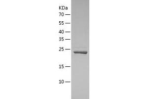 Western Blotting (WB) image for Ubiquitin Specific Peptidase 8 (USP8) (AA 886-1096) protein (His tag) (ABIN7286099) (USP8 Protein (AA 886-1096) (His tag))