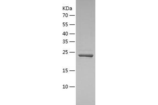 USP8 Protein (AA 886-1096) (His tag)