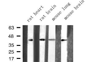 Western blot analysis of ARFIP1 expression in various lysates (ARFIP1 antibody  (Internal Region))