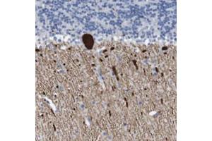 Immunohistochemical staining (Formalin-fixed paraffin-embedded sections) of human cerebellum with ITPR1 polyclonal antibody  shows strong cytoplasmic positivity in Purkinje cells. (ITPR1 antibody)
