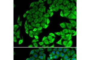 Immunofluorescence analysis of MCF-7 cells using RPL14 Polyclonal Antibody (RPL14 antibody)