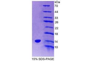 SDS-PAGE (SDS) image for Pre-B Lymphocyte 1 (VPREB1) (AA 43-128) protein (His tag) (ABIN2126395)