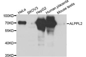 Western blot analysis of extracts of various cell lines, using ALPPL2 antibody (ABIN5975268) at 1/1000 dilution. (ALPPL2 antibody)