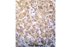 Immunohistochemistry in Formalin-fixed, Paraffin embedded human liver tissue stained with Syntaxin 2 / STX2 Antibody (Center) followed by peroxidase conjugation of the secondary antibody and DAB staining. (STX2 antibody  (Middle Region))