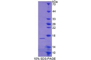 SDS-PAGE (SDS) image for Hexokinase 1 (HK1) (AA 80-215) protein (His tag) (ABIN1170641) (Hexokinase 1 Protein (HK1) (AA 80-215) (His tag))