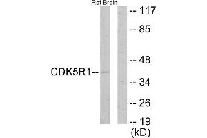 Western blot analysis of extracts from rat brain cells, using CDK5R1 antibody. (CDK5R1 antibody  (N-Term))