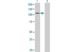 Western Blot analysis of PLD1 expression in transfected 293T cell line by PLD1 monoclonal antibody (M01), clone 2F3. (PLD1 antibody  (AA 965-1074))