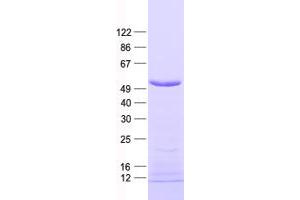 Validation with Western Blot