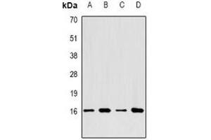 Western blot analysis of LC3A expression in SHSY5Y (A), HepG2 (B), BT474 (C), mouse brain (D) whole cell lysates. (MAP1LC3A antibody)