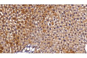 Immunohistochemistry (IHC) image for anti-Keratin 18 (KRT18) (AA 1-423) antibody (ABIN7437488)