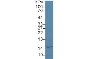 Detection of aLA in Bovine Milk using Polyclonal Antibody to Alpha-Lactalbumin (aLA) (LALBA antibody  (AA 12-142))