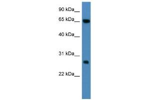 WB Suggested Anti-KBTBD8 Antibody Titration: 0. (KBTBD8 antibody  (N-Term))