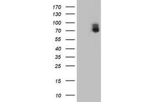 HEK293T cells were transfected with the pCMV6-ENTRY control (Left lane) or pCMV6-ENTRY ILVBL (Right lane) cDNA for 48 hrs and lysed. (ILVBL antibody)