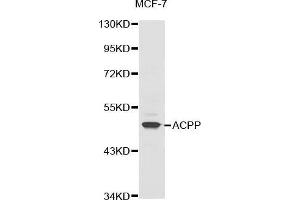 Western blot analysis of extracts of MCF-7 cell line, using ACPP antibody. (ACPP antibody  (AA 40-300))