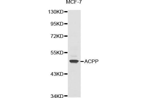 ACPP 抗体  (AA 40-300)