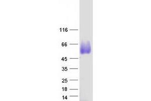 Validation with Western Blot