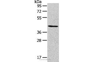 Western blot analysis of Human kidney cancer tissue, using RUNX2 Polyclonal Antibody at dilution of 1:105 (RUNX2 antibody)