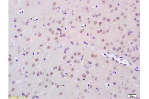 Formalin-fixed and paraffin embedded rat brain tissue labeled with Anti-FTO/Protein Fatso Polyclonal Antibody, Unconjugated (ABIN872957) at 1:200 followed by conjugation to the secondary antibody (FTO antibody  (AA 165-265))