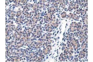 Image no. 2 for anti-Leucine Carboxyl Methyltransferase 1 (LCMT1) antibody (ABIN1499107) (LCMT1 antibody)