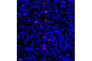 Immunofluorescence of paraffin embedded mouse nephritis using CD177 (ABIN7073372) at dilution of 1:500 (400x lens) (CD177 antibody)