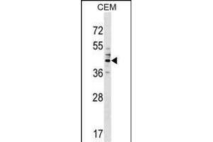 CEAC Antibody (Center) (ABIN1537994 and ABIN2849399) western blot analysis in CEM cell line lysates (35 μg/lane). (CEACAM6 antibody  (AA 188-214))