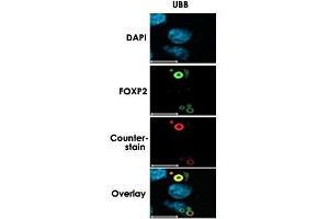 Characterization of FOXP2 Isoforms. (Ubiquitin B antibody  (C-Term))