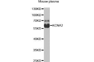 Western blot analysis of extracts of mouse plasma, using KCNA2 antibody (ABIN1980311) at 1:1000 dilution. (KCNA2 antibody)