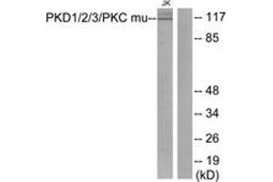 Western blot analysis of extracts from Jurkat cells, using PKD1/2/3/PKC mu (Ab-744/748) Antibody. (PKD1/2/3/PKC mu (AA 706-755) antibody)