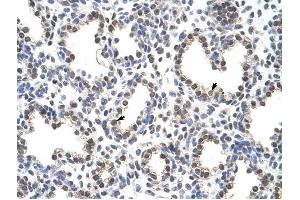 FLJ12529 antibody was used for immunohistochemistry at a concentration of 4-8 ug/ml to stain Alveolar cells (arrows) in Human Lung. (CPSF7 antibody  (C-Term))