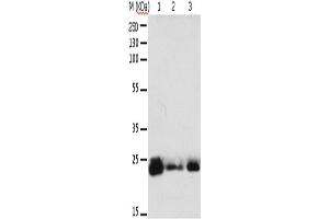 Western Blotting (WB) image for anti-RAB6A, Member RAS Oncogene Family (RAB6A) antibody (ABIN2425553) (RAB6A antibody)
