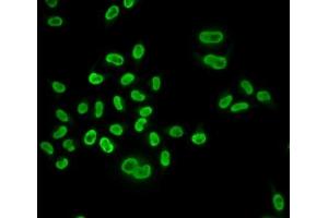 Immunofluorescence (IF) image for anti-Minichromosome Maintenance Complex Component 6 (MCM6) (AA 562-821) antibody (ABIN3022687)