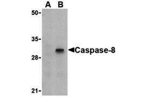 Western Blotting (WB) image for anti-Caspase 8 (CASP8) (C-Term) antibody (ABIN1030320) (Caspase 8 antibody  (C-Term))