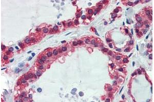 Human Thyroid: Formalin-Fixed, Paraffin-Embedded (FFPE) (GAPDH antibody  (AA 9-323))