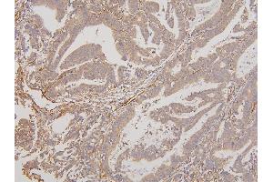 IHC analysis of RAB3GAP2 using anti-RAB3GAP2 antibody (ABIN6719633).