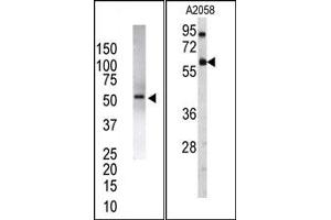 Image no. 2 for anti-Ubiquitin Specific Peptidase 14 (USP14) (N-Term) antibody (ABIN357546) (USP14 antibody  (N-Term))
